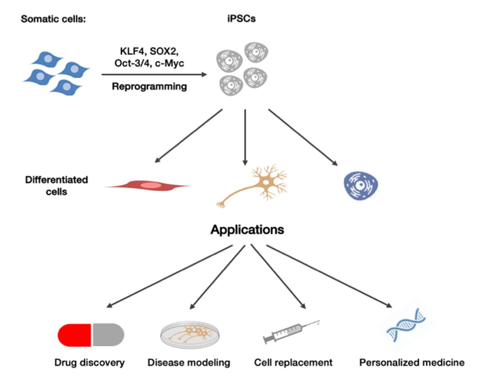 Unlocking Parkinson's Disease