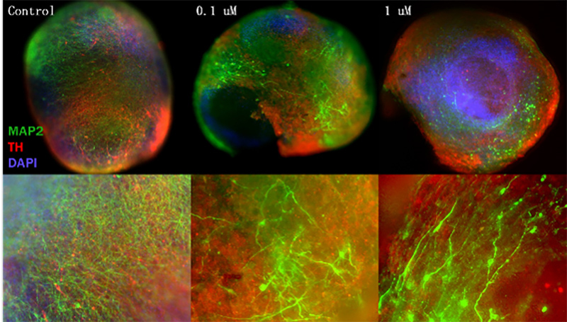 Unlocking Parkinson's Disease
