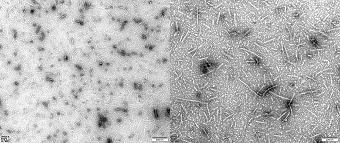 PFFs morphology (electron microscopy)