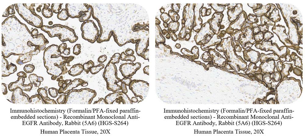  EGF R CONTROL SAMPLE