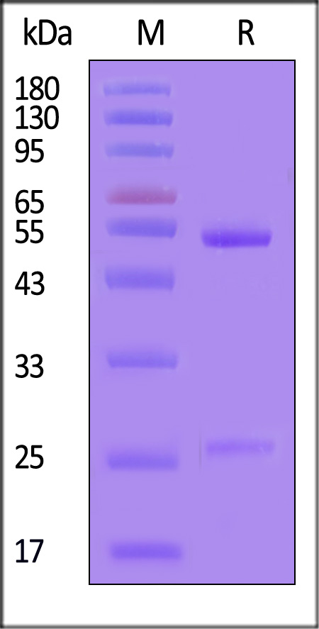 IgG control SDS-PAGE