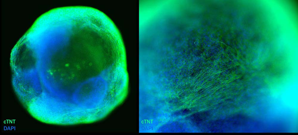  Organoids MARKER EXPRESSION